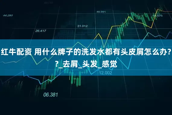 红牛配资 用什么牌子的洗发水都有头皮屑怎么办??_去屑_头发_感觉